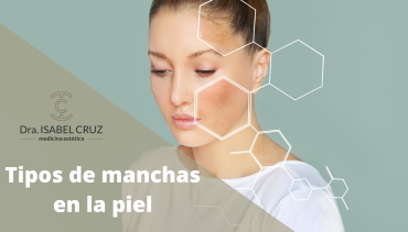 Tipos de manchas solares y cómo evitarlas